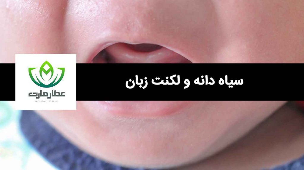 کودکی که لکنت زبان دارد و با سیاه دانه می توان درمان کرد.
